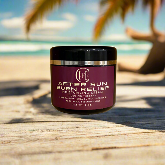 After Sun Burn Relief